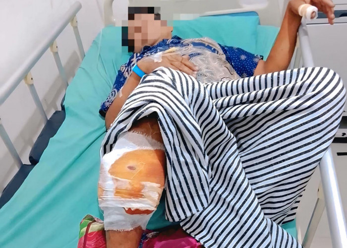 Seorang Warga OKU Diserang Beruang di Kebun Karet