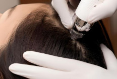 Kiat Perawatan Kulit Kepala untuk Rambut Lebih Tebal dan Bercahaya