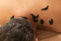 Redakan Nyeri Sendi dan Peradangan Otot dengan Terapi Lintah