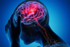 Cegah Bahaya Penyakit Stroke dengan Menerapkan Kebiasaan-Kebiasaan Ini!