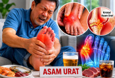 Asam Urat: Ini Pemicu dan Cara Mengatasi Secara Alami 
