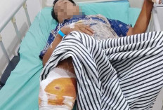 Petani di OKU Diserang Beruang saat Menyadap Karet, Begini Kondisi Korban 
