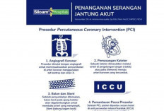 Ketahui Gejala dan Prosedur PCI untuk Serangan Jantung Akut