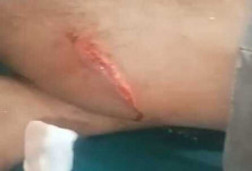 Seorang Petani di Rawas Ilir Jadi Korban Penganiayaan Brutal