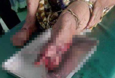 Diserang buaya kaki warga Megang Sakti Putus