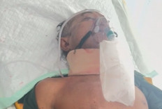 Masuk Lubang, Pengendara Revo Alami Luka Berat