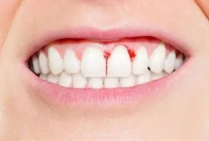 Gigi Goyang? Tanda Masalah Gusi dan Penyangga Gigi!