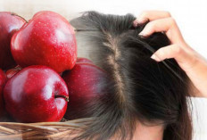 Kulit Kepala Kering Jadi Cerita Lama: Tips Perawatan Rambut ala Apel yang Harus Anda Coba!