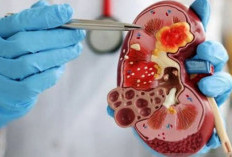 Pasien Hipertensi, Diabetes, dan Obesitas Rentan Alami Gagal Ginjal