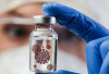 Asal Usul Virus Nipah yang Kini Mengancam Dunia