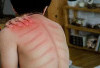 Tips Jitu Mengatasi Tubuh yang Mudah Masuk Angin